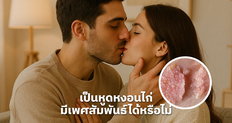 เป็นหูดหงอนไก่ มีเพศสัมพันธ์ได้หรือไม่