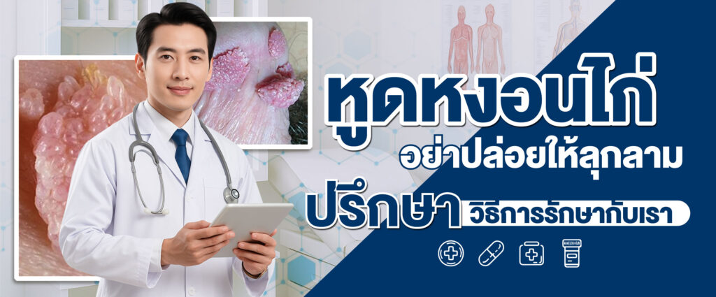 รักษาหูดหงอนไก่