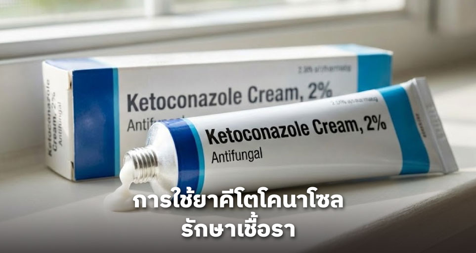 การใช้ยาคีโตโคนาโซล (Ketoconazole) รักษาเชื้อรา