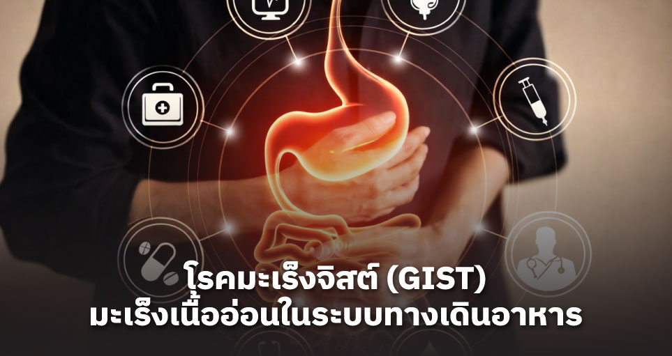 รู้จักกับโรคมะเร็งจิสต์ (GIST) มะเร็งเนื้ออ่อนในระบบทางเดินอาหารที่รักษาได้