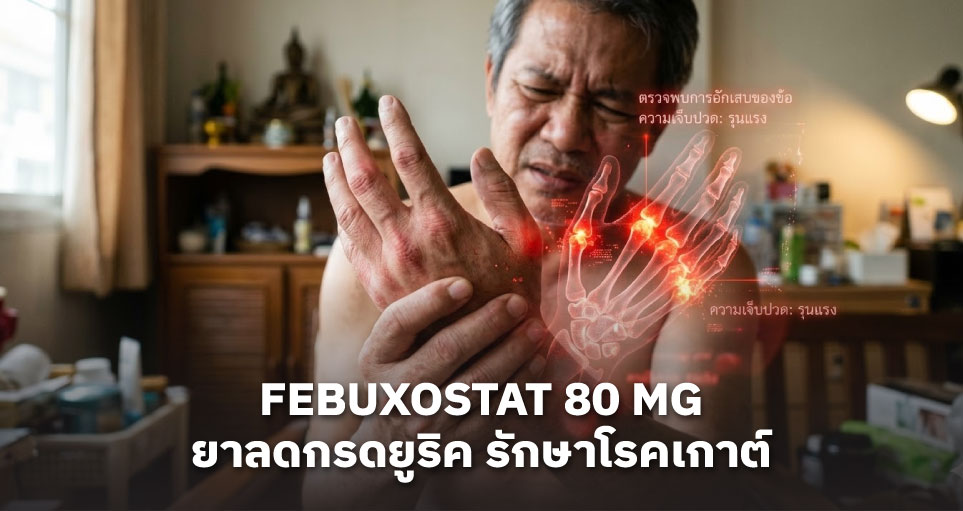 Febuxostat 80 mg คืออะไร: ยาลดกรดยูริค รักษาโรคเกาต์ วิธีกิน ผลข้างเคียง