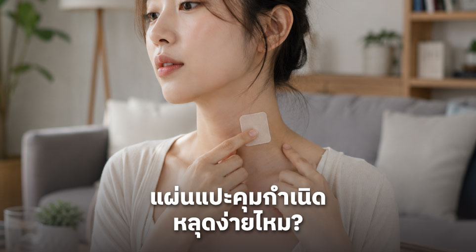 แผ่นแปะคุมกำเนิด หลุดง่ายไหม?