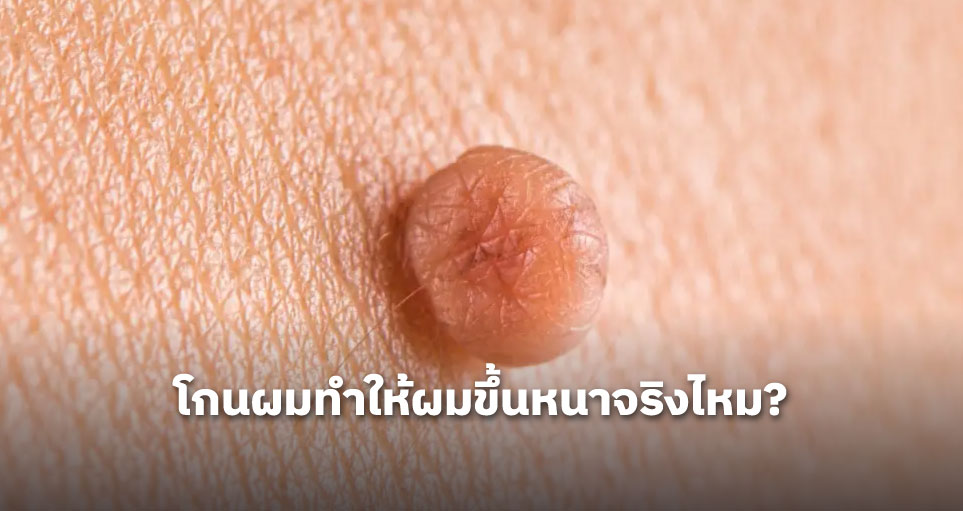หงอนไก่กับติ่งเนื้อ ต่างกันยังไง?
