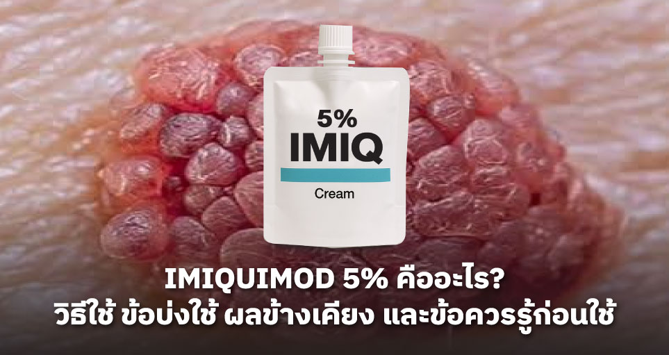 Imiquimod 5% คืออะไร? วิธีใช้ ข้อบ่งใช้ ผลข้างเคียง และข้อควรรู้ก่อนใช้