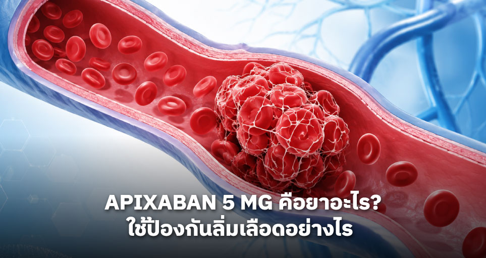 APIXABAN 5 MG คือยาอะไร? ใช้ป้องกันลิ่มเลือดอย่างไร และต้องระวังอะไรบ้าง