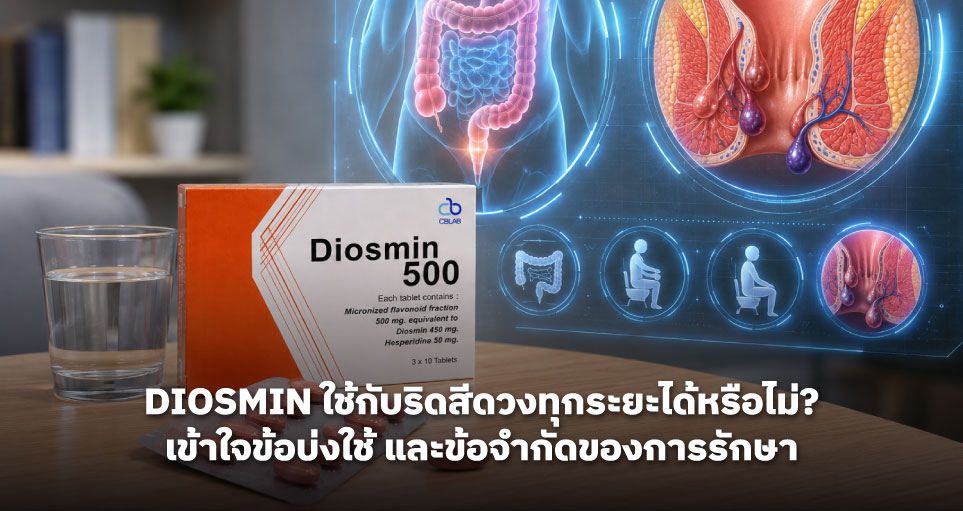 Diosmin ใช้กับริดสีดวงทุกระยะได้หรือไม่? เข้าใจข้อบ่งใช้ และข้อจำกัดของการรักษา