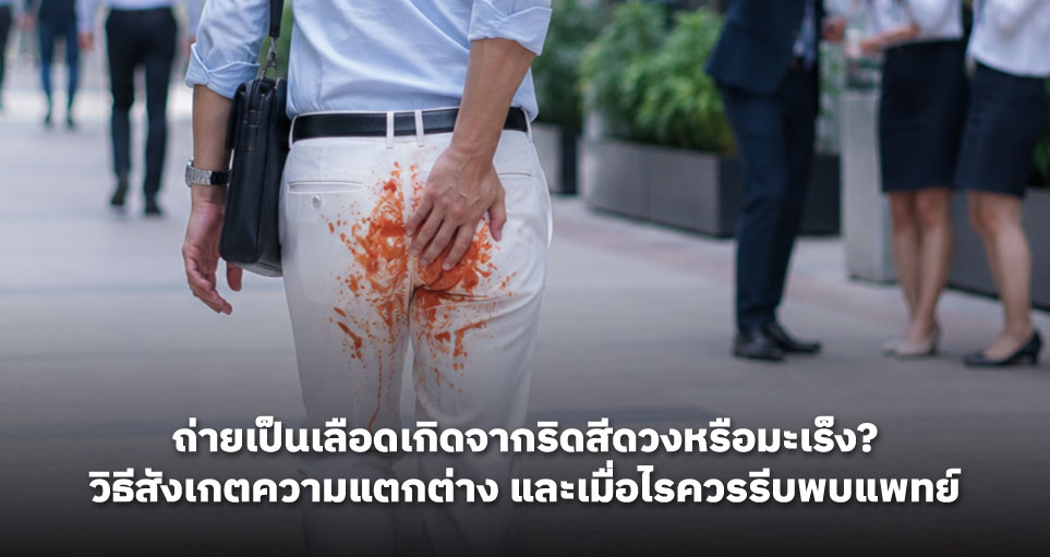 ถ่ายเป็นเลือดเกิดจากริดสีดวงหรือมะเร็ง? วิธีสังเกตความแตกต่าง และเมื่อไรควรรีบพบแพทย์