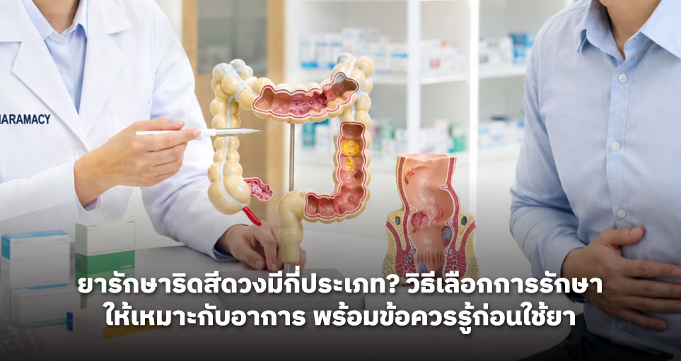 ยารักษาริดสีดวงมีกี่ประเภท? วิธีเลือกการรักษาให้เหมาะกับอาการ พร้อมข้อควรรู้ก่อนใช้ยา