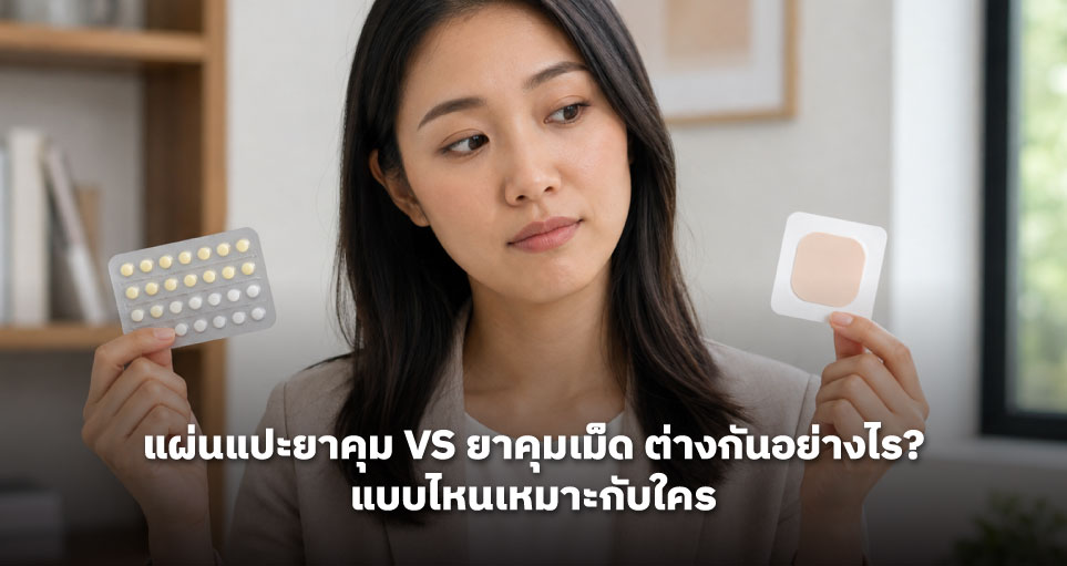 แผ่นแปะยาคุม vs ยาคุมเม็ด ต่างกันอย่างไร? แบบไหนเหมาะกับใคร