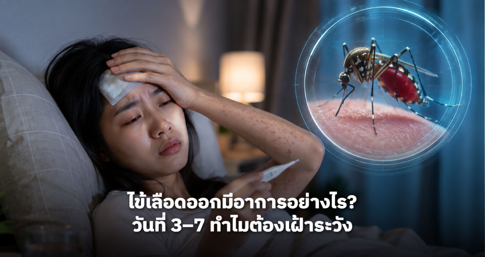 ไข้เลือดออกมีอาการอย่างไร? วันที่ 3–7 ทำไมต้องเฝ้าระวัง