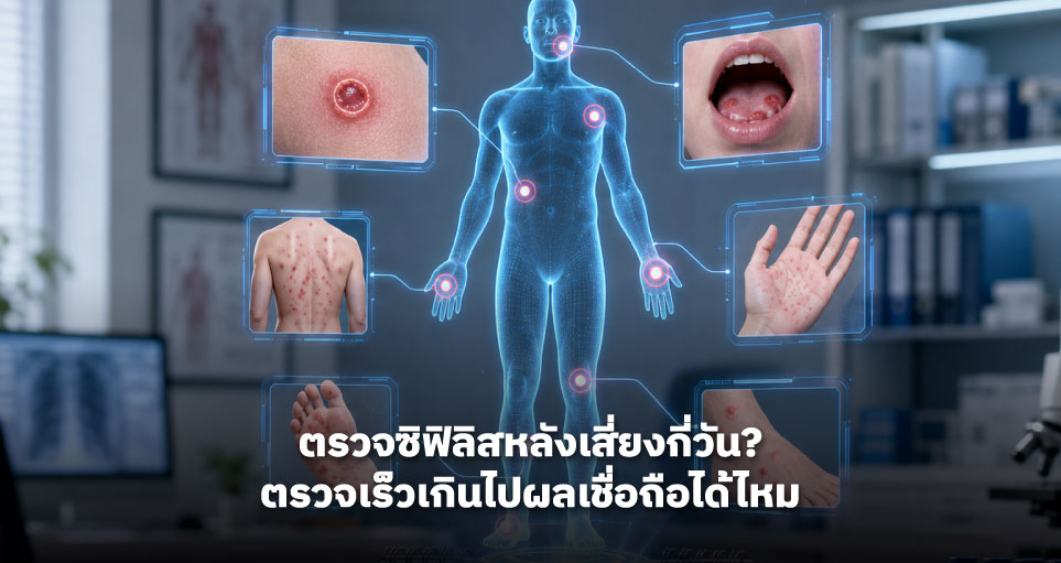 ตรวจซิฟิลิสหลังเสี่ยงกี่วัน? ตรวจเร็วเกินไปผลเชื่อถือได้ไหม