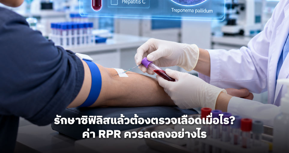 รักษาซิฟิลิสแล้วต้องตรวจเลือดเมื่อไร? ค่า RPR ควรลดลงอย่างไร