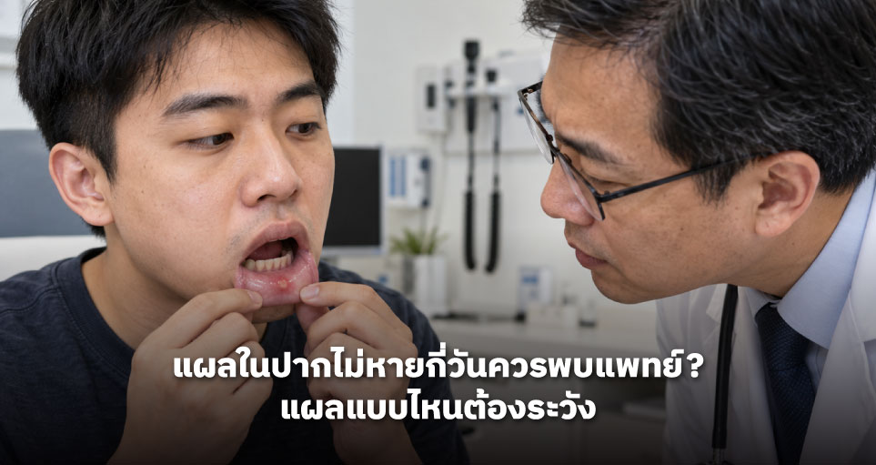 แผลในปากไม่หายกี่วันควรพบแพทย์? แผลแบบไหนต้องระวัง