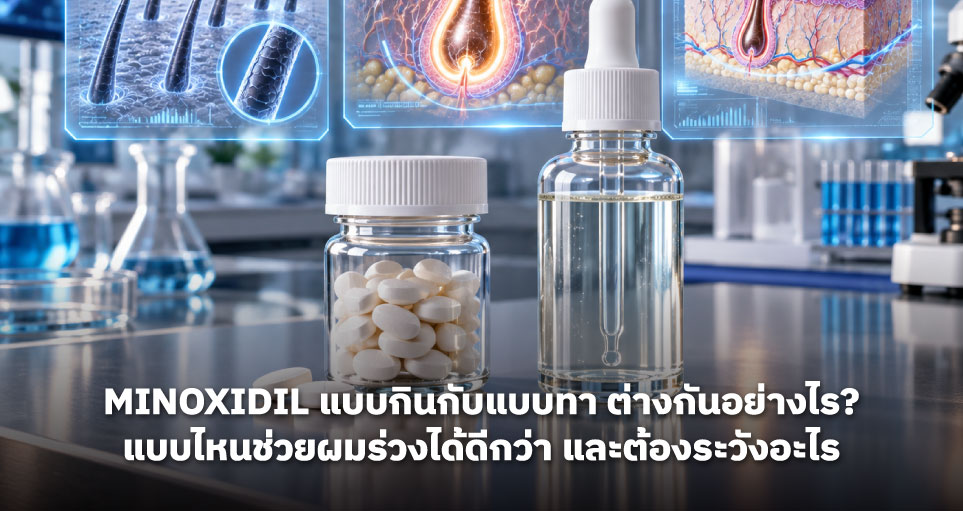 Minoxidil แบบกินกับแบบทา ต่างกันอย่างไร? แบบไหนช่วยผมร่วงได้ดีกว่า และต้องระวังอะไร