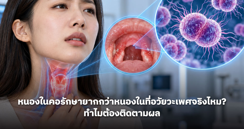 หนองในคอรักษายากกว่าหนองในที่อวัยวะเพศจริงไหม? ทำไมต้องติดตามผล