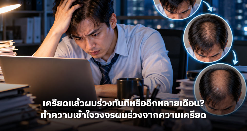 เครียดแล้วผมร่วงทันทีหรืออีกหลายเดือน? ทำความเข้าใจวงจรผมร่วงจากความเครียด