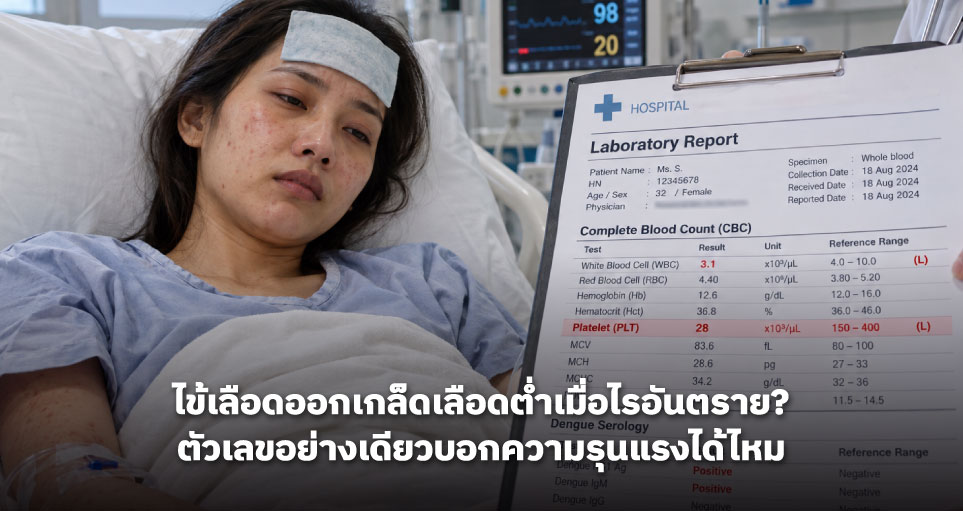 ไข้เลือดออกเกล็ดเลือดต่ำเมื่อไรอันตราย? ตัวเลขอย่างเดียวบอกความรุนแรงได้ไหม